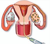 瑪特納說明書來了,組成成分、生產國家這都有