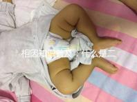 相因知識(shí)普及：什么是二代試管嬰兒