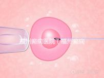 福州癲癇醫(yī)院（福州癲癇醫(yī)院在哪里）