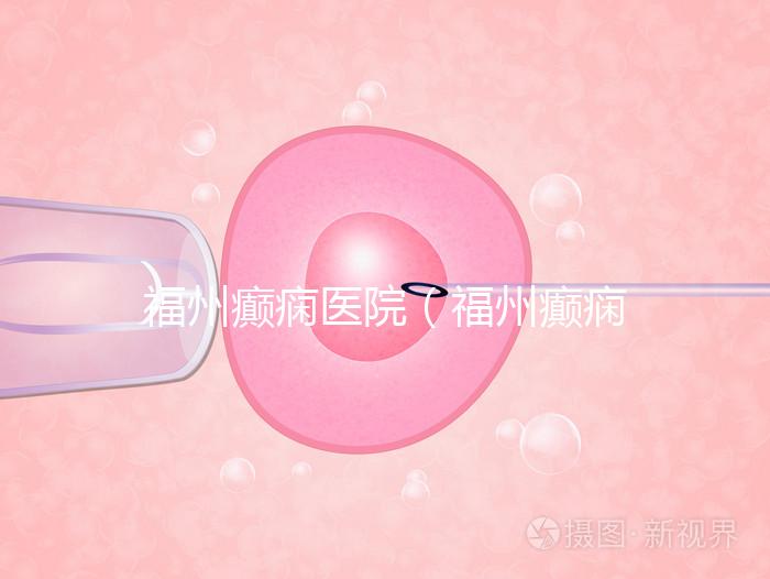 福州癲癇醫(yī)院（福州癲癇醫(yī)院在哪里）