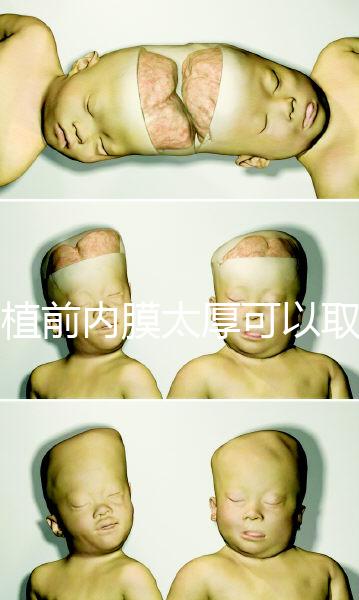 移植前內(nèi)膜太厚可以取卵早知道,疼痛因人而異