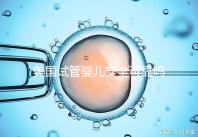 美國試管嬰兒安全可靠嗎?了解基本原理和安全性?