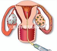 兒童入學再無阻礙!國家現(xiàn)已禁止體檢中檢查乙肝