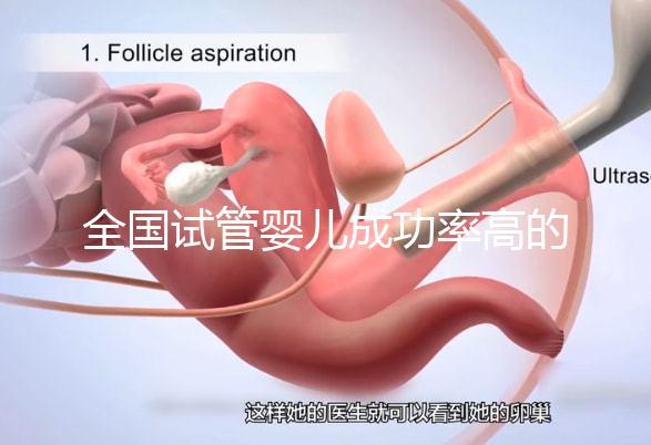 全國(guó)試管嬰兒成功率高的醫(yī)院排名，內(nèi)附2023試管費(fèi)用及成功率參考