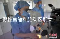 假性宮縮和胎動(dòng)區(qū)別大！孕36周頻繁宮縮與這兩者有關(guān)聯(lián)