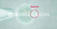 做試管結婚證要查真?zhèn)螁幔ㄗ鲈嚬芙Y婚證要查真?zhèn)螁岫嗌馘X)