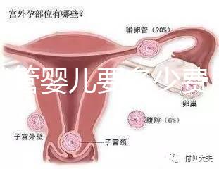做試管嬰兒要多少費用（做試管嬰兒要多少費用？）