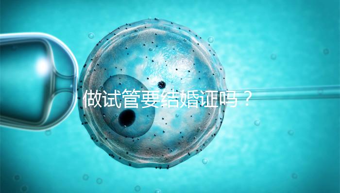 做試管要結婚證嗎?