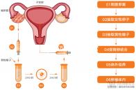 凍精可不可以做一代試管別沒數(shù),生小孩關(guān)鍵在這幾點(diǎn)