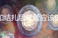 告知結扎后試管應該做什么準備，是否有照片檢查，有答案