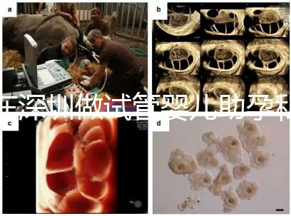 在深圳做試管嬰兒助孕私人機(jī)構(gòu)收費標(biāo)準(zhǔn)是怎樣的