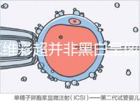 二維彩超并非黑白呈像，通過檢查還能看清胎兒五官