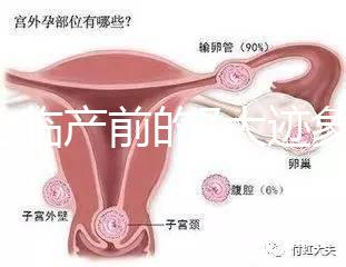 二胎臨產前的7大跡象，出現見紅、陣痛別大意