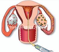 為什么不建議12月齡寶寶打水痘疫苗，醫(yī)生道出其中端倪
