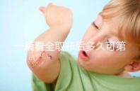 一篇看全取卵后多久可第二次促排卵和移植，做試管的進(jìn)