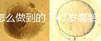 怎么做到的？47歲高齡試管嬰兒唯一男胚一次移植成功！