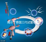 揭示了泰國三代試管成功率高的原因，以及優秀的技術 完美結合全方位服務