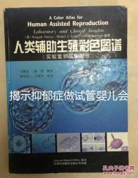 揭示抑郁癥做試管嬰兒會遺傳給女兒,想避免看這個