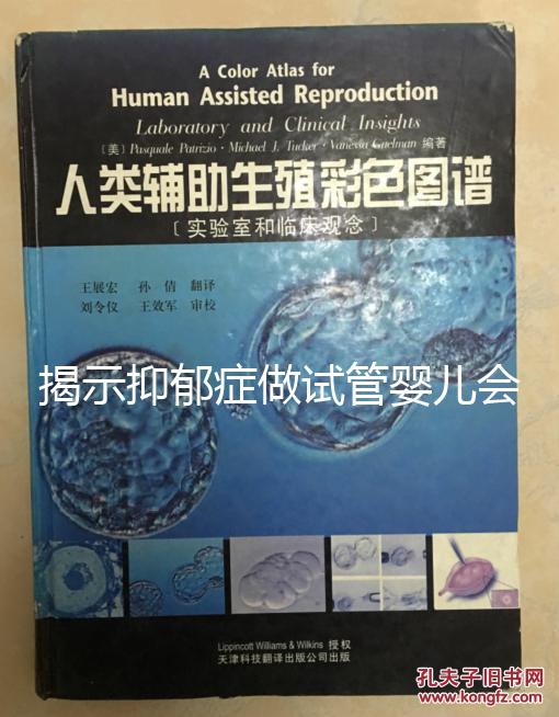 揭示抑郁癥做試管嬰兒會遺傳給女兒，想避免看這個