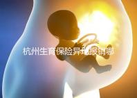 杭州生育保險異地報銷哪個部門快拿到?不知道能不能申請引產