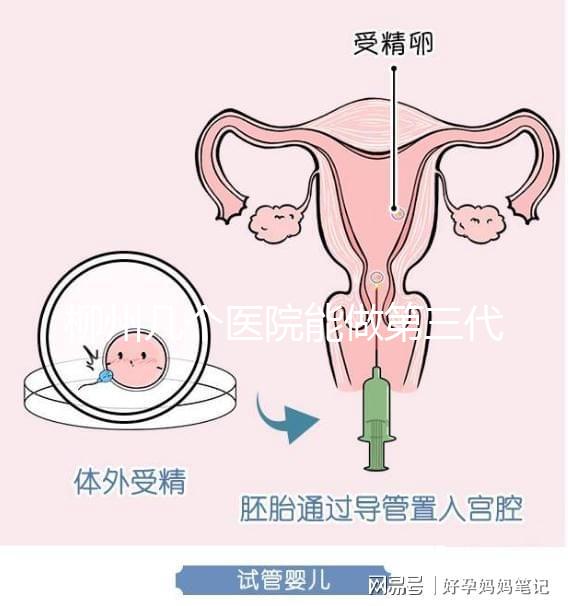 柳州幾個醫院能做第三代試管嬰兒？詳細的費用成功率都在這