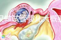 武漢做試管嬰兒大概要多少錢？