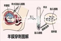 浙江三代試管最好的公立醫院推薦，參考性大隨你挑