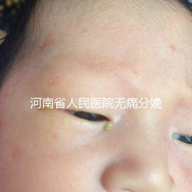 河南省人民醫院無痛分娩多少錢戳，收費標準60s看懂不踩坑