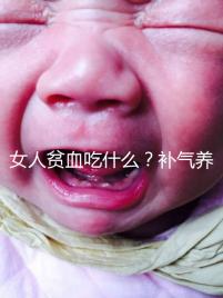 女人貧血吃什么？補氣養血，掌握這五個技巧，讓你煥發青春光彩