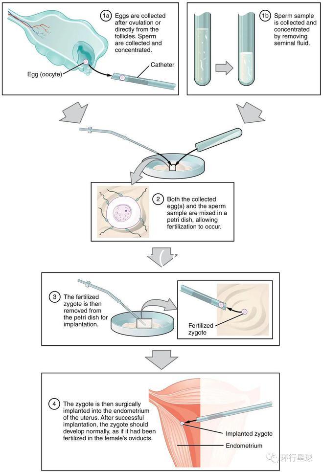 婦科病癥狀(婦科病癥狀表現有哪些呢)