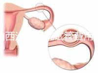 山西汾陽醫(yī)院試管費用清單公布，2024年生殖科助孕成功率公布