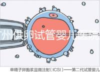廣州供卵試管嬰兒醫(yī)院匯總，真實案例告訴你廣東哪家最好