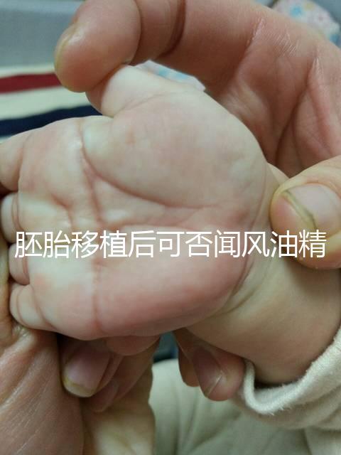 胚胎移植后可否聞風油精速覽，導致著床失敗真不是鬧著玩