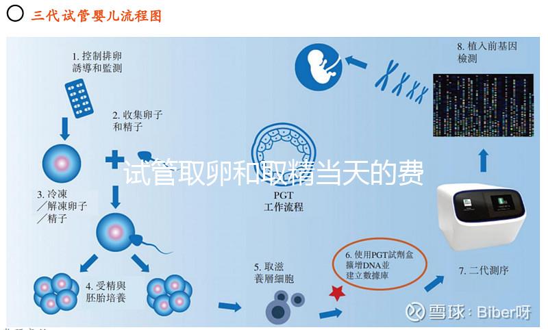 試管取卵和取精當天的費用明細表，大概多少錢一清二楚