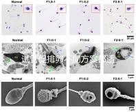 試管促排卵不同方案都適合哪些人？如何監測排卵？