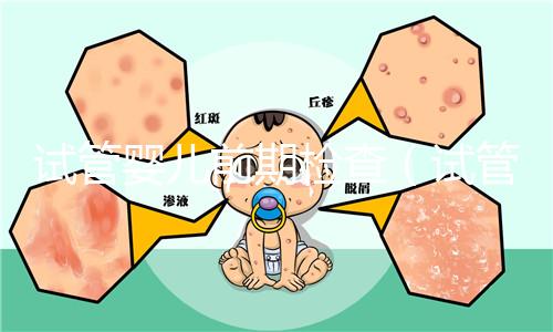 試管嬰兒前期檢查（試管嬰兒前期檢查項(xiàng)目和流程）