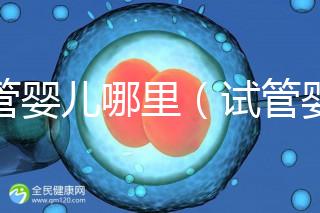 試管嬰兒哪里(試管嬰兒哪里做的最好的醫(yī)院)