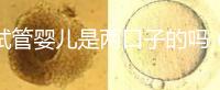 試管嬰兒是兩口子的嗎(試管嬰兒是兩夫妻的孩子嗎)