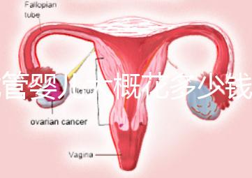試管嬰兒大概花多少錢(試管嬰兒大概花多少錢費用)
