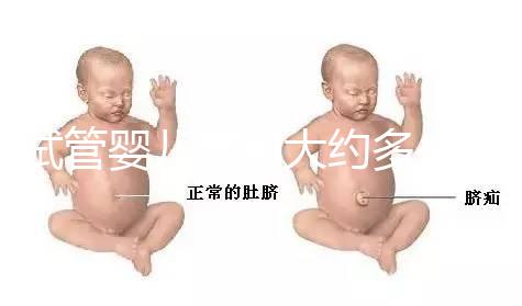 試管嬰兒費用大約多少2021年（試管嬰兒費用大約多少2021年鄭州）