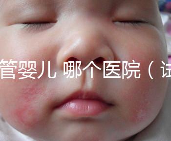 試管嬰兒 哪個醫(yī)院(試管嬰兒哪個醫(yī)院做的最好)