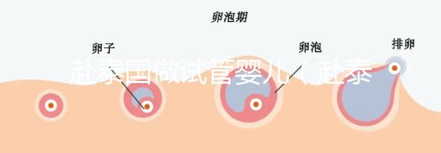 赴泰國(guó)做試管嬰兒(赴泰國(guó)做試管嬰兒要多少錢(qián))