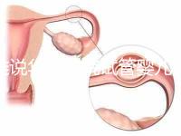 誰說華西二院試管嬰兒成功率不高，那是你沒選對(duì)生殖醫(yī)生