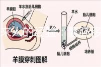 過來人的經(jīng)驗：囊胚移植第13天少量出血未必是壞事