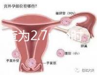 nt檢查為2.7mm時危險性莫亂猜,做完無創后才能確定